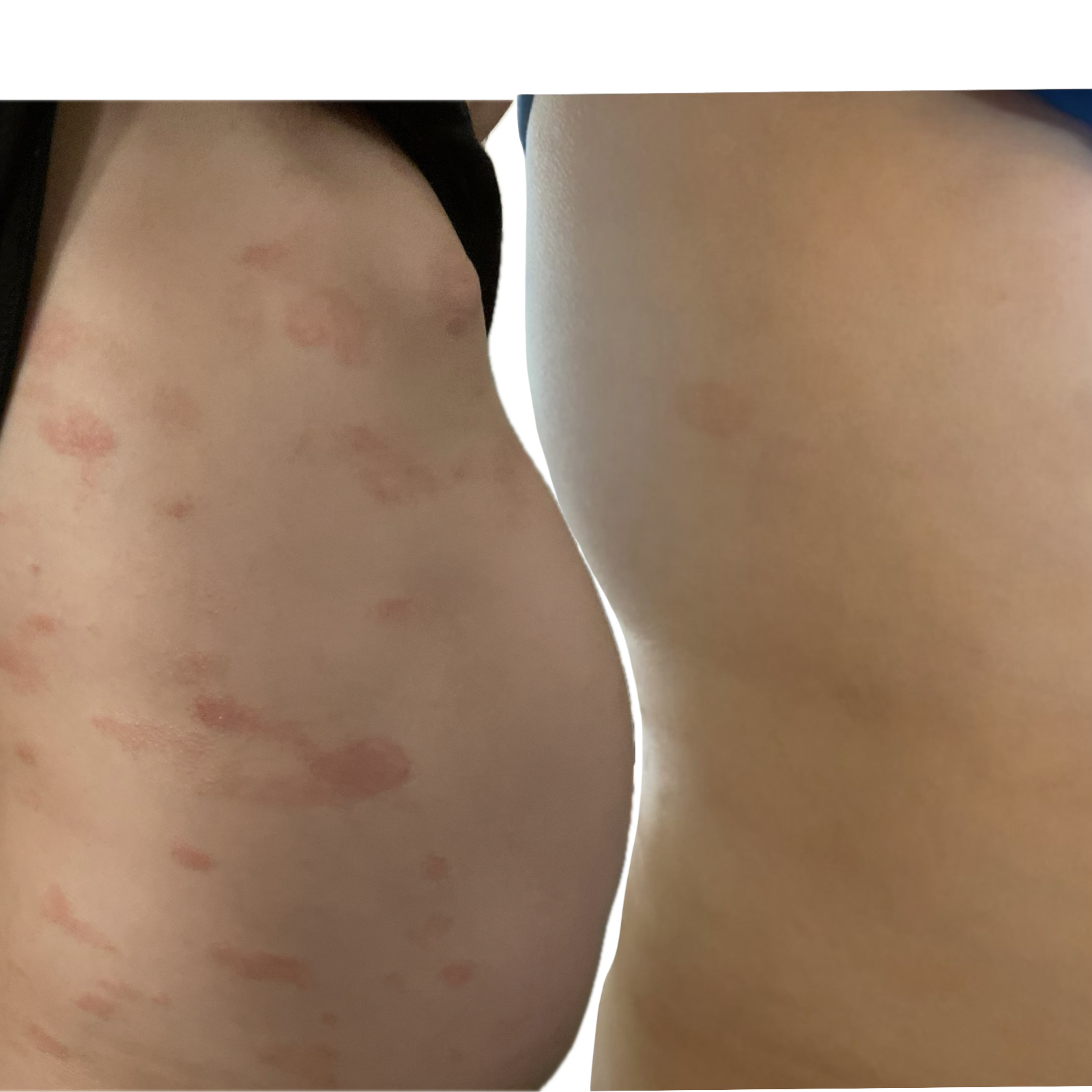BEFORE + AFTER