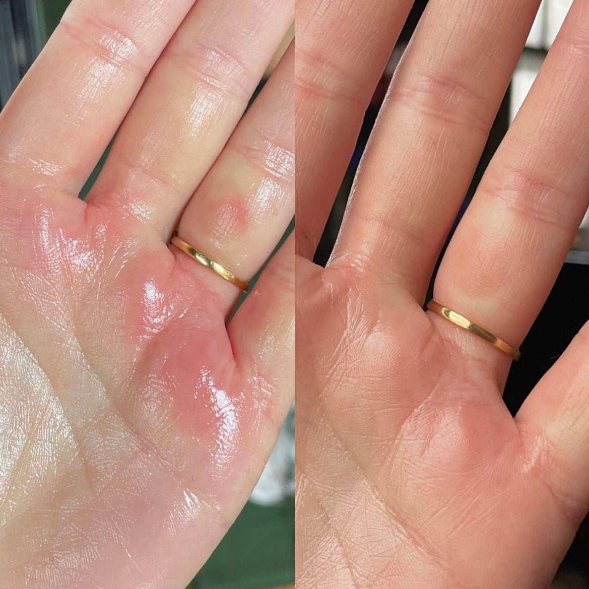 BEFORE + AFTER